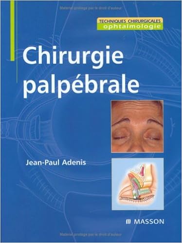 Amazon Fr Chirurgie Palpebrale Ancien Prix Editeur 129 Euros Adenis Jean Paul Livres
