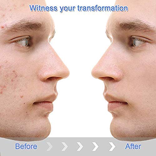 Blackhead Vacuum, 2019 Upgraded Rechargeable Blackhead Vacuum Suction Remover, Professional Portable Pore Vacuum Led Display Electric Pore Suction Vacuum with 4 Beauty Probes for Men for women