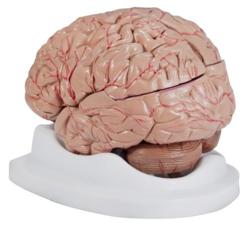 Budget Brain with Arteries Model