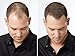 ESPIRITU DE CANELA CINNAMON SPIRIT OIL MEN WOMEN HAIR LOSS BALDING REGROWTH TREATMENT by Pharmark