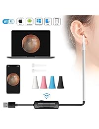 TSAAGAN   Endoscopio de limpieza de orejas, 3 en 1, USB, cámara digital de inspección de otoscopio de oreja, herramienta de limpieza de oreja con 6 luces LED para Android Smartphone, Viudas, Mac PC