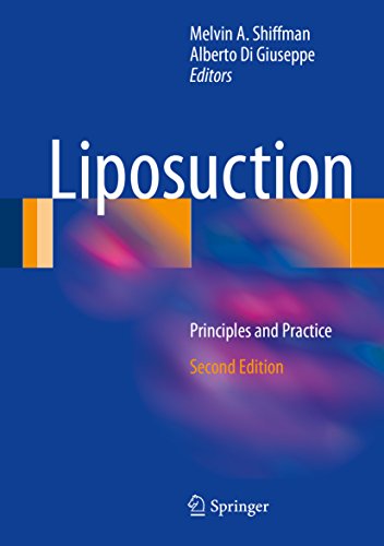 Liposuction: Principles and Practice