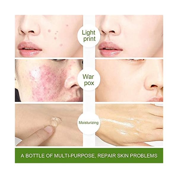 500g-Aloe-Vera-Gel-Natural-Face-Creams-Moisturizer-Acne-Treatment-Organic-aloe-vera-gel-100-pure-Gel-for-Skin-Repairing-Natural-Beauty-Products Aloe Vera Gel 500 ml, Natural Gel Moisturizer Acne Treatment, Organic aloe vera gel 100 pure,Gel for Skin Repairing…