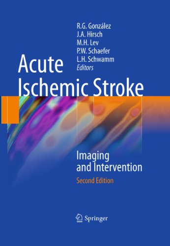 Acute Ischemic Stroke: Imaging and Intervention by Springer