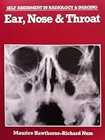 Ear, nose & throat (Self assessment in radiology) 0723415544 Book Cover