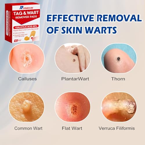 LBOYLOVE® 42 Pack Wart Corn Remover Pads for Feet, 40% Salicylic Acid Wart Remover Pads, Corn Removers for Toes, Extra Strength Bandages for Plantar Warts, Corns, Callus on Feet