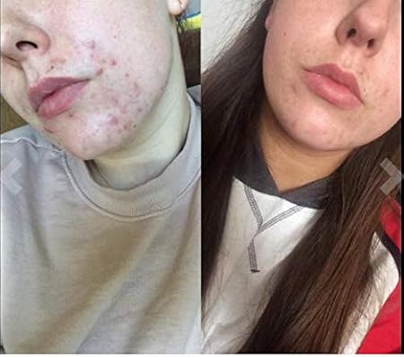 sunkissed face serum