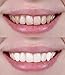 Mia Adora Teeth Whitening Activated Charcoal with Coconut - Natural Teeth Whitening at Home - Mint Flavor - Snow Effect