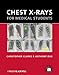 Chest X-rays for Medical Students