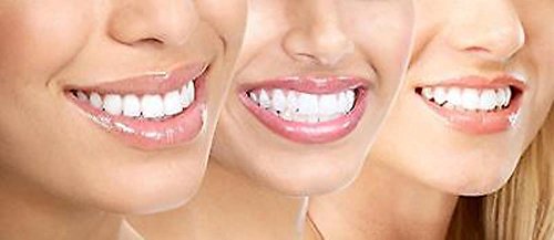 The Complete Professional 3D At Home Teeth Whitening Kit- See Results Fast! - Thumbnail 3
