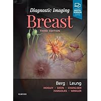 Breast Imaging: 9780323051989: Medicine & Health Science Books
