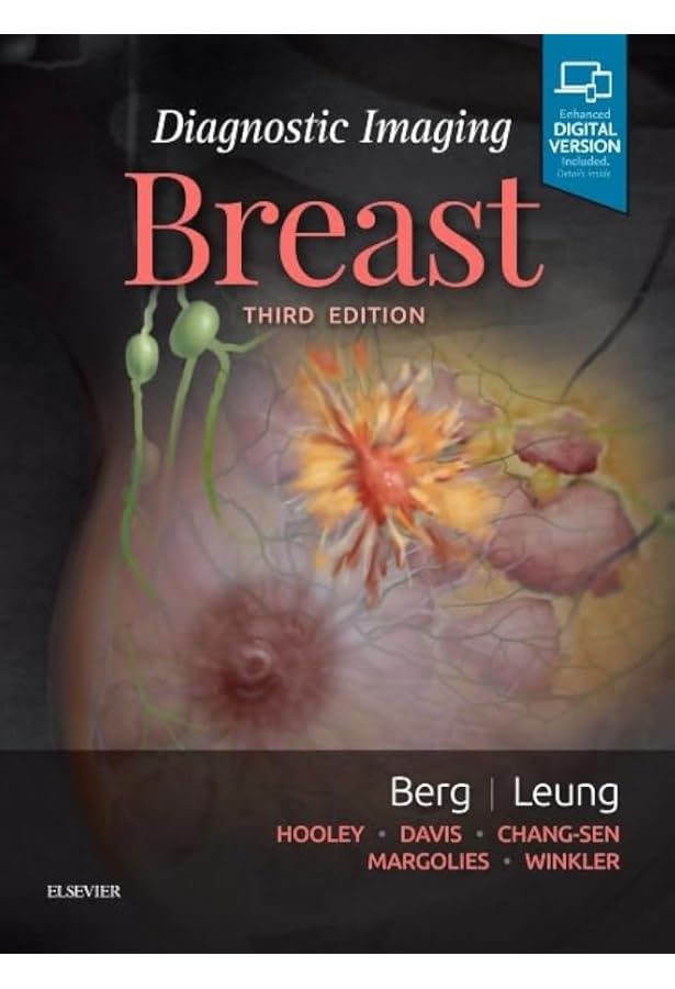 Breast Ultrasound by A. Thomas Stavros MD FACR (2003-12-29