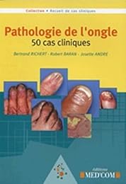 Pathologie de l'ongle