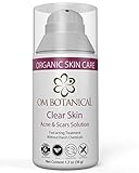 Best Natural Acne FACE Treatment & Scar Removal Cream for Teens, Men, Women | Clear Skin - Benzoyl Peroxide Free Fast Remedy for Cystic, Hormonal, Teen, Adult & Body Acne Pimples | Safe Organic Vegan
