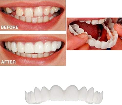 Whitening Cosmetic Upper Veneer Denture Teeth One Size Fits Most Comfortable Upper Veneer