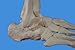 Wellden Medical Anatomical Foot Skeleton Model,disarticulated and Assembled by Magnets, Life Size