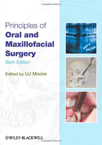 Principles of Oral and Maxillofacial Surgery 6e