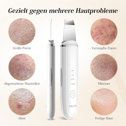 4 in 1 ANLAN Ultrasonic Skin Cleanser Facial Cleanser - Deep Cleansing, Vibrating Scrub, Facial Care and Blackhead Removal