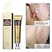 LanBeNa Acne Scar Mark Removal Gel Ointment, 30g (1.05oz) .