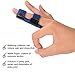 Corpower Trigger Finger Splint