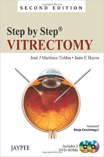 Buy Dr Hoyos Step By Step Vitrectomy Inc 2 Dvd Roms Book Online At Low Prices In India Dr Hoyos Step By Step Vitrectomy Inc 2 Dvd Roms Reviews Ratings Amazon In