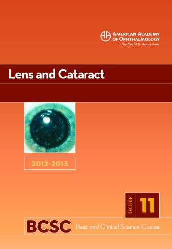 2012-2013 BASIC AND CLINICAL SCIENCE COURSE (BCSC) SECTION 11: LENS AND CATARACT
