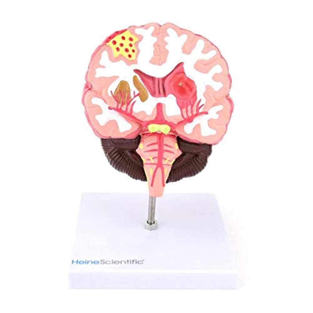 HeineScientific Apoplex Model