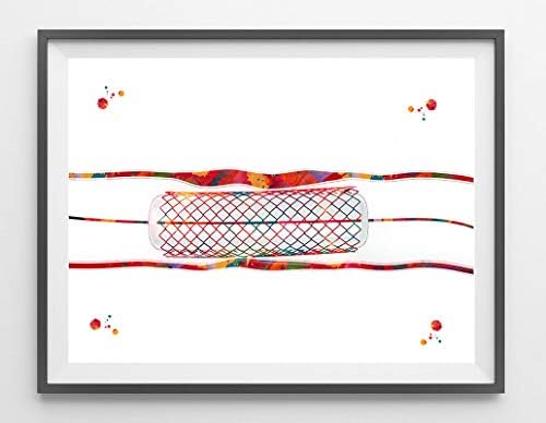 ntART Heart Surgery Art Print Stent Watercolor Anatomy Art Coronary Stent Poster Circulatory System Balloon Angioplasty Cardiology Clinic Art Framed Wall Art