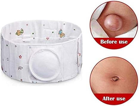 Amazon Co Jp 子供臍ヘルニアベルト 赤ちゃんのへそトラスサポート 幼児腹部バインダー 109 Size Xl ホーム キッチン