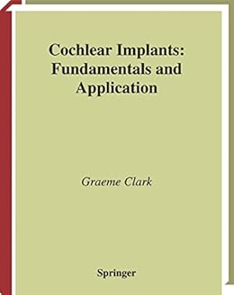 Cochlear Implants Fundamentals And Applications Modern