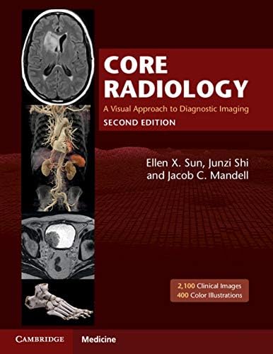 Amazon.com: Osborn's Brain E-Book eBook : Osborn MD, FACR, Anne G