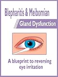 Blepharitis & Meibomian Gland Dysfunction: a blueprint to reversing eye irritation