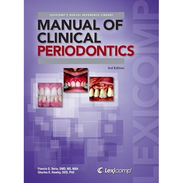 語学+参考書 Periodontics (2) (Dental clinical series basic) DENTAL CLINICAL SERIES BASIC Periodontics 2 重度歯周病罹患歯