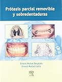 Protesis Parcial Removible y Sobredentadura, Mallat, Stéphane, 8481746576