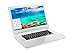 Acer Chromebook 15 CB5-571-C4T3 (15.6-Inch HD, 2GB RAM, 16GB SSD)