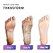 Exfoliating Sock Foot Mask - Baby Foot Peel Mask Calluses and Dead Skin Away - 2 Pairs (4 Pcs) - Lavender Scent