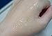 [BONAJOUR] Extreme Acne Blemish Spot Repair & Remove Serum - The Best Acne Blemish Clear Repair & Brightening & Remove Acne Serum 1.7Fl.oz