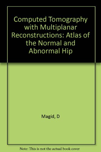 Computed Tomography With Multiplanar Reconstructions: An Atlas of the Normal and Abnormal Hip