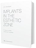 Implants in the Esthetic Zone: A Step-by-Step