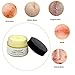 Scar Removal Cream,Scar Cream,Scar Treatment,Skin Repair Cream,Treatment for FaceBody Scar,Acne Spots,Stretch Mark Cream, Old and New Scars and Surgical Scars,For Men & Women 50ml