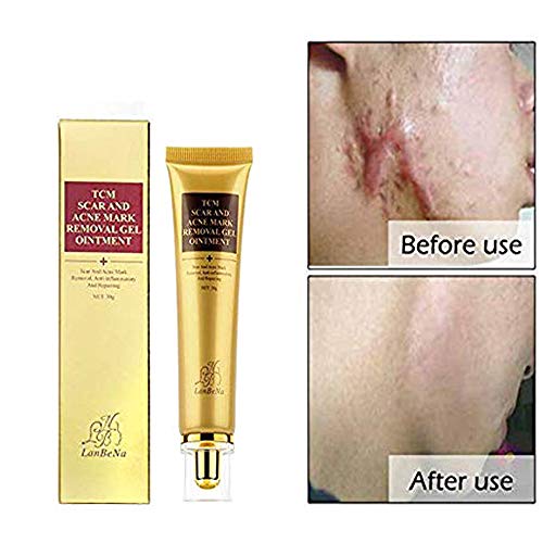 TCM Scar Removal Cream, Acne Treatment Acn Control Acne Scar Removal Gel Skin Repair for Face ear Leg Body Scarring Acne Spots Stretch Burn Scar Remover Marks 30ml (1)