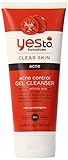 Yes To Tomatoes Acne Control Gel Cleanser, 5.25 Fluid Ounce