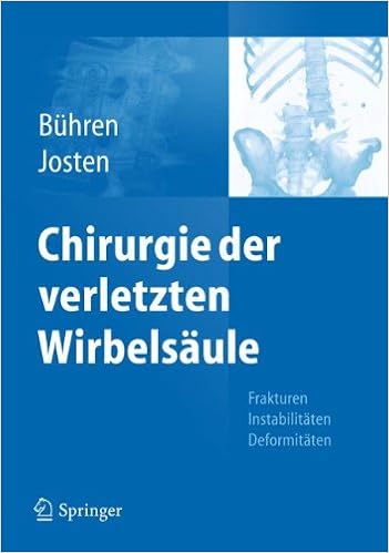 Chirurgie Der Verletzten Wirbelsäule Frakturen - 