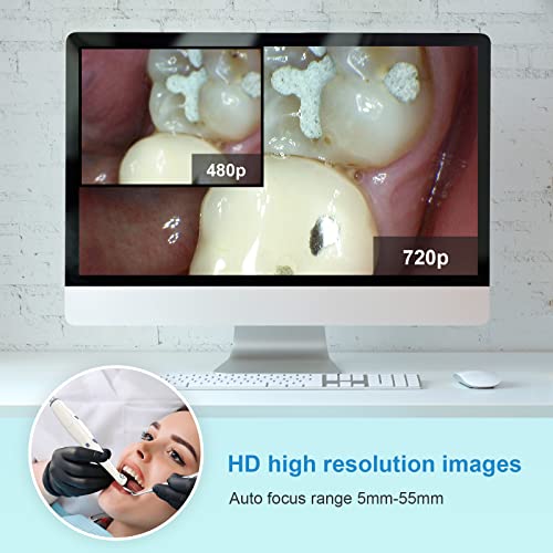 HD Intraoral Camera ProDENT PD720, USB Dental Intraoral Camera, Capture