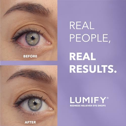 LUMIFY Eye Drops for Red Eyes, Redness Reliever for Brighter Looking Eyes, Works in 1 Minute & Lasts Up to 8 Hours, Eye Drops, 0.25 Fl Oz (7.5mL)