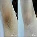 Ultra Brightening Spotless Serum Dark Spots Removal Age Spots Hyper-Pigmentation (YUES)