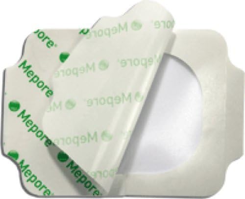 Molnlycke Health Care Mepore Self-adhesive Transparent Film Dressing 6 x 8-1/2 (Box of 10 Each) by Molnlycke Wound Care