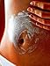 Best Stretch Mark Microdermabrasion Crystals 3lbs- Most Effective treatment for Old White Stretch Marks pure Stretch Mark Microdermabrasion Medical Crystals for manual use 3lbs shown to remove dead skin cells, exfoliate rough skin,repair scars and old white stretch marks, fade sunspots from sun damage,leaves skin glowing, smooth and younger looking