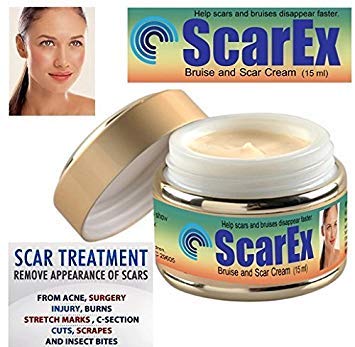 mark removal cream for skin