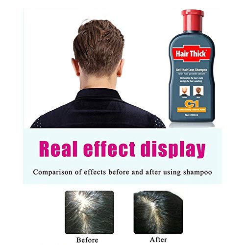 Fast Hair Growth Shampoo Herbal Repair Damaged Coarse Anti Hair Loss Serum Unisex (100ml)